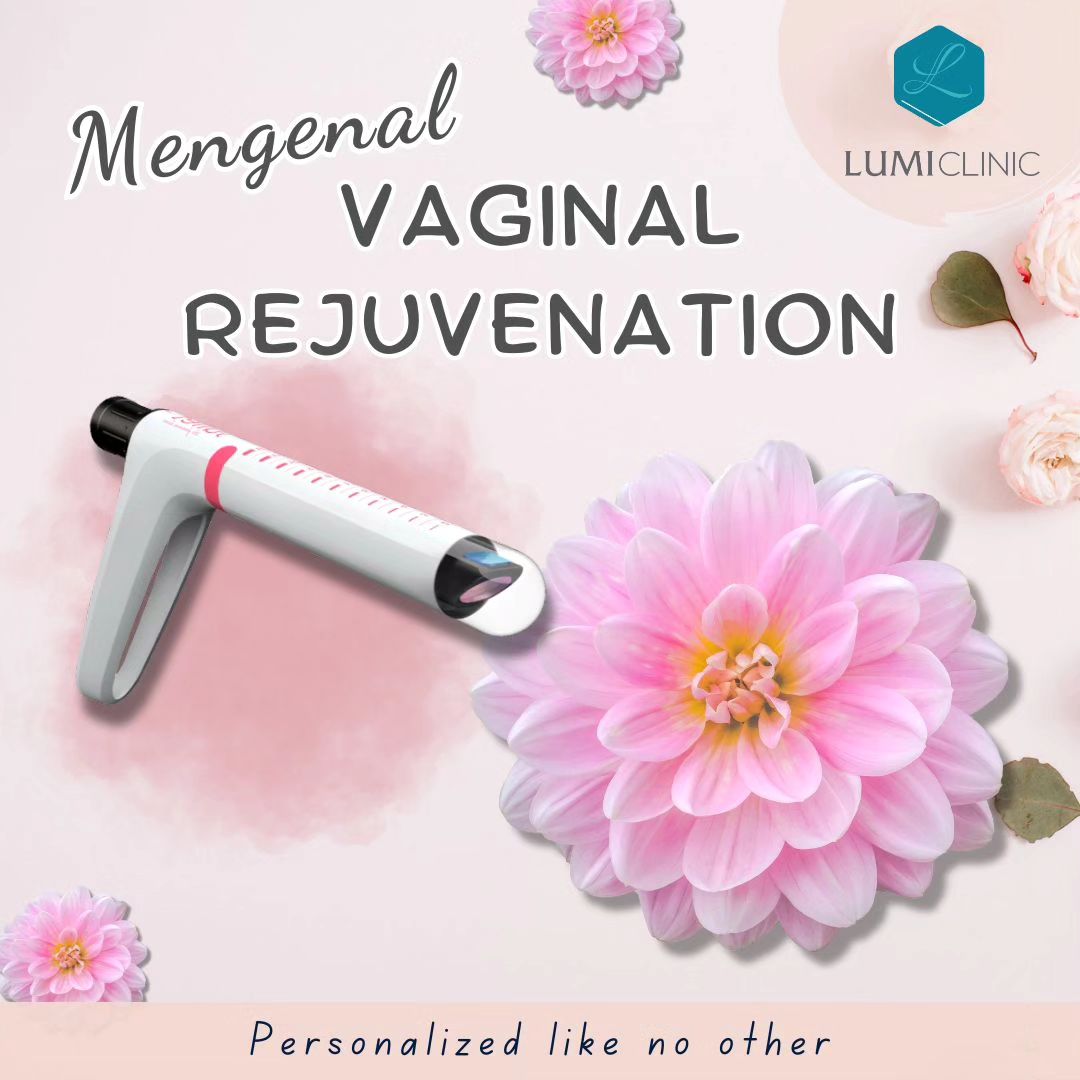 Laser-Vaginal-Tightening.jpg
